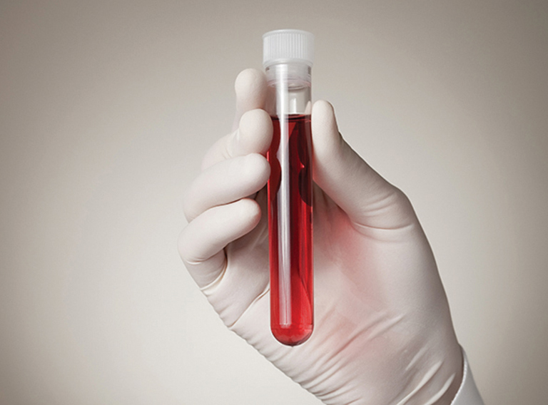 Multiple Sclerosis research in vitro-to-patient toolbox